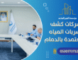 شركات كشف تسربات المياه المعتمدة بالدمام